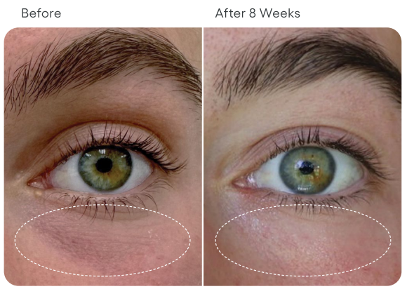 Plated Eye Serum Before After