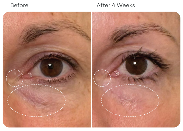 Plated Eye Serum Before After 2