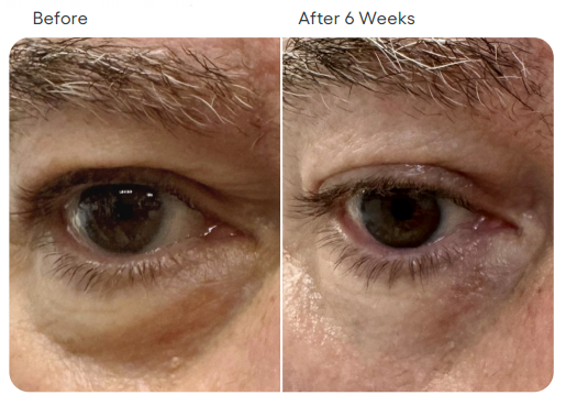 Plated Eye Serum Before After 3